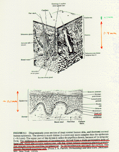 image11.gif